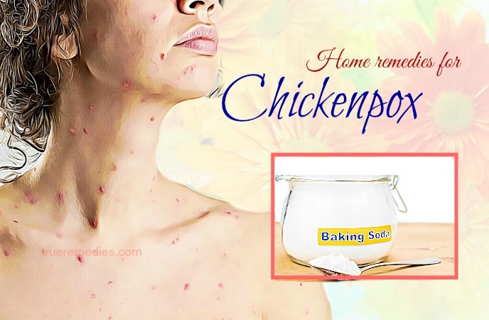 home remedies for chickenpox 