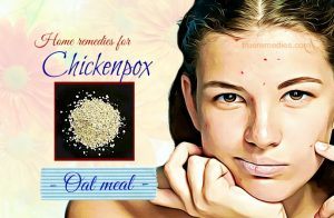 25 Proven Home Remedies For Chickenpox In Infants & Adults