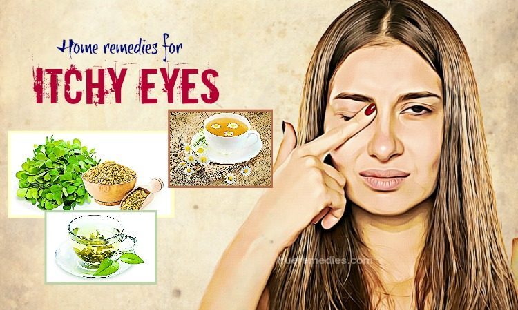 home remedies for itchy eyes