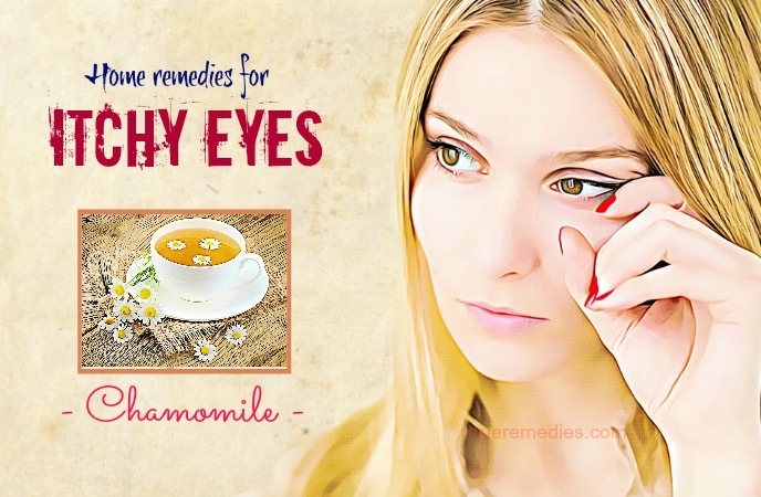 home remedies for itchy eyes 
