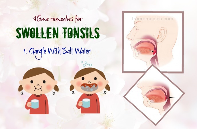 home remedies for swollen tonsils 