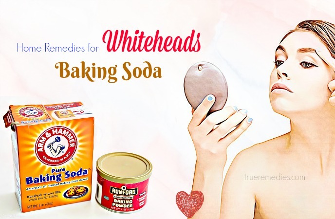 home remedies for whiteheads 