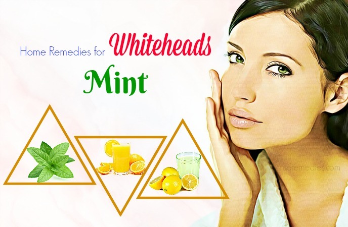 home remedies for whiteheads - mint