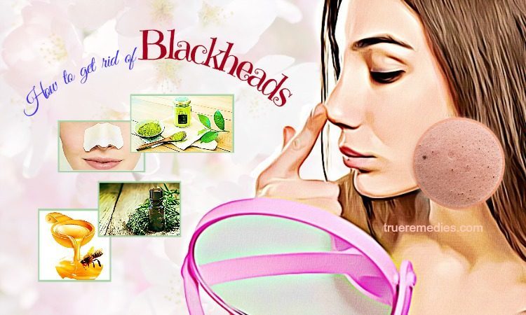 how to get rid of blackheads