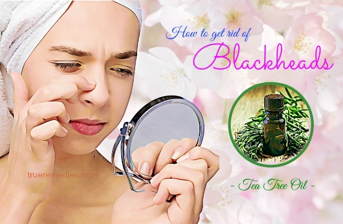 how to get rid of blackheads 