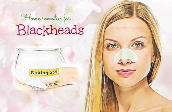 home remedies for blackheads 