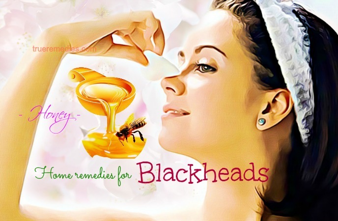 home remedies for blackheads