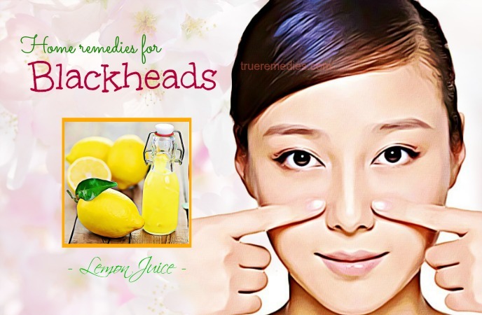 home remedies for blackheads 