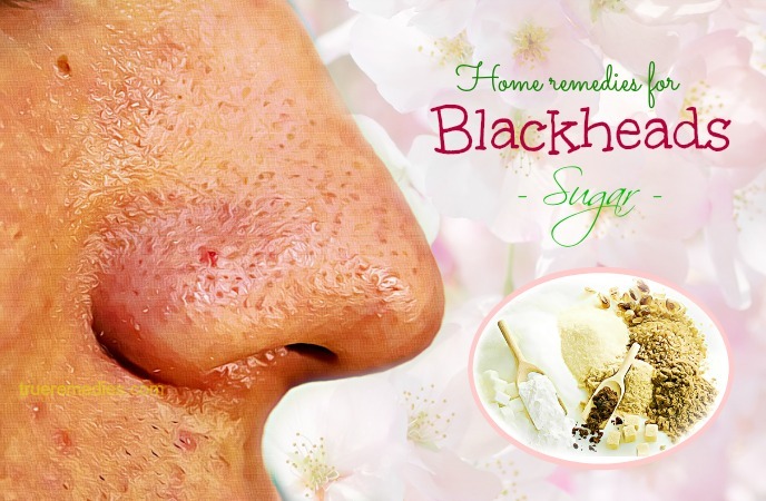 home remedies for blackheads - sugar