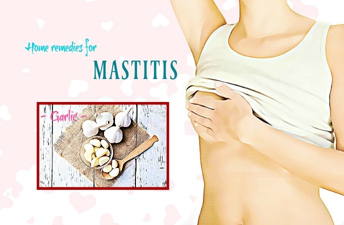 home remedies for mastitis