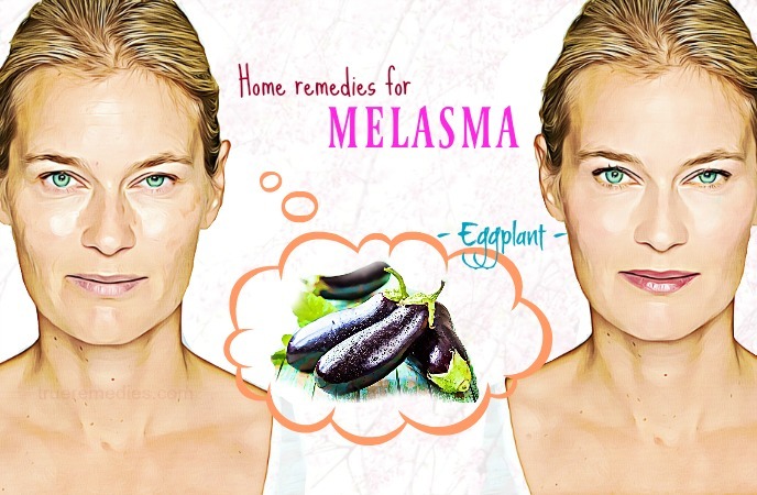 home remedies for melasma 