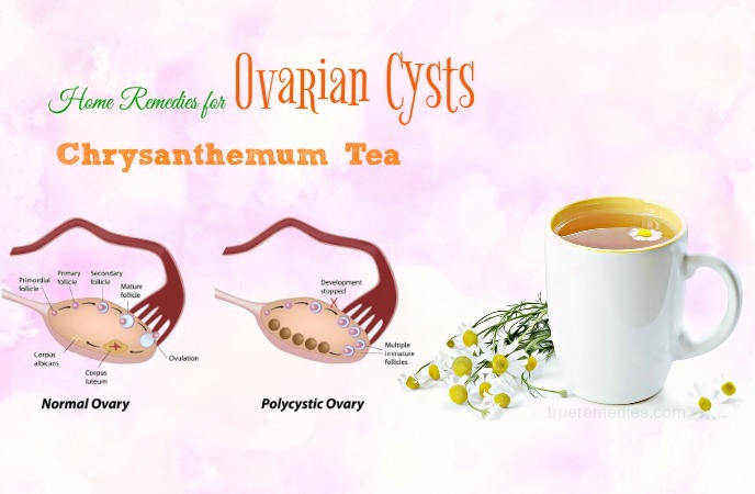 home remedies for ovarian cysts 