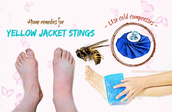 home remedies for yellow jacket stings 