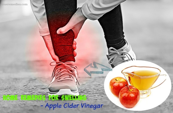 home remedies for swelling - apple cider vinegar