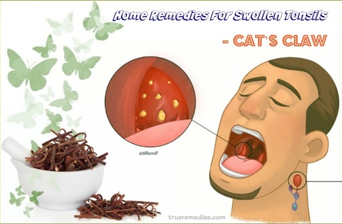home remedies for swollen tonsils - cat’s claw
