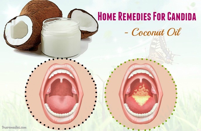 home remedies for candida - coconut oil