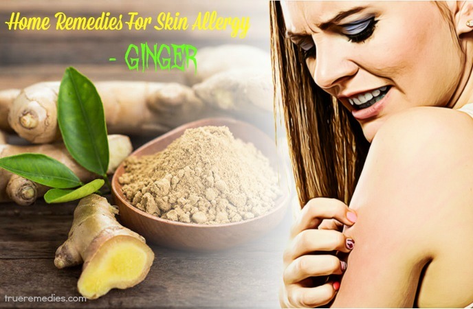 home remedies for skin allergy - ginger