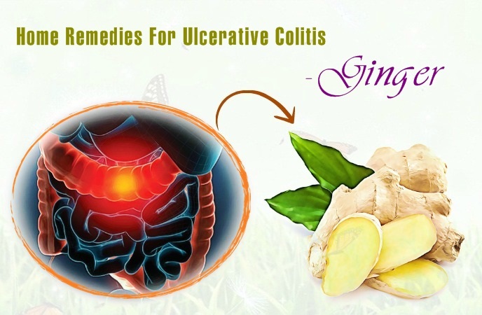 home remedies for ulcerative colitis - ginger