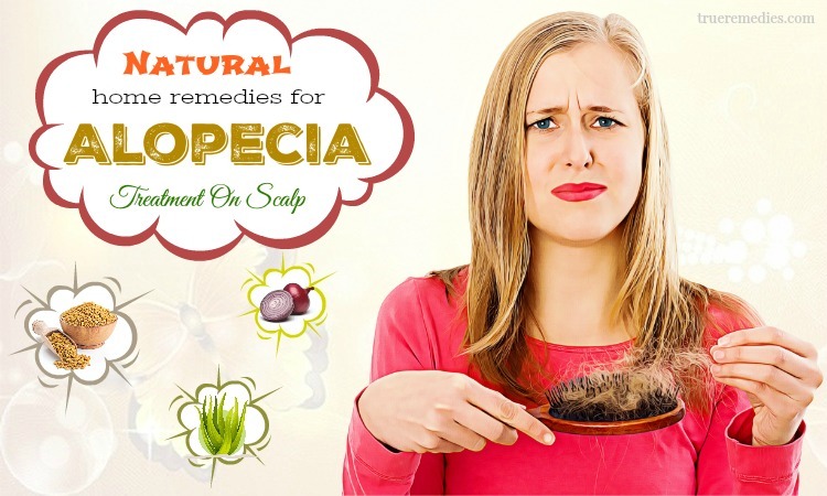 home remedies for alopecia treatment