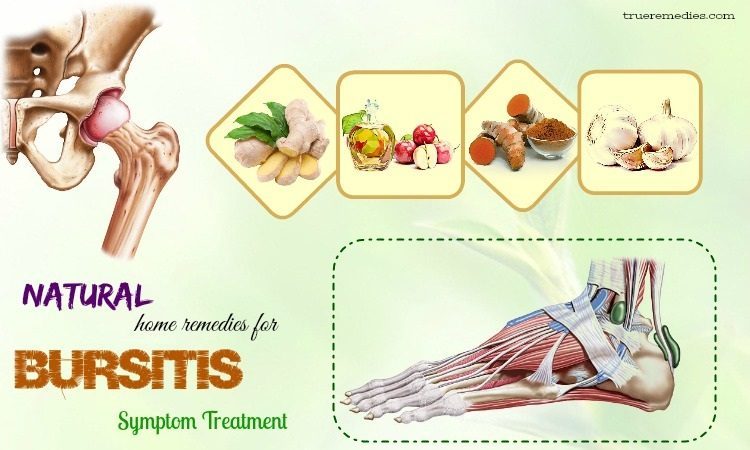 natural home remedies for bursitis
