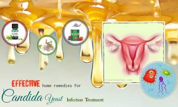 home remedies for candida yeast infection