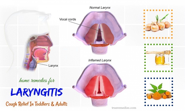home remedies for laryngitis in toddlers