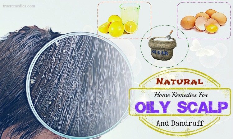 natural home remedies for oily scalp