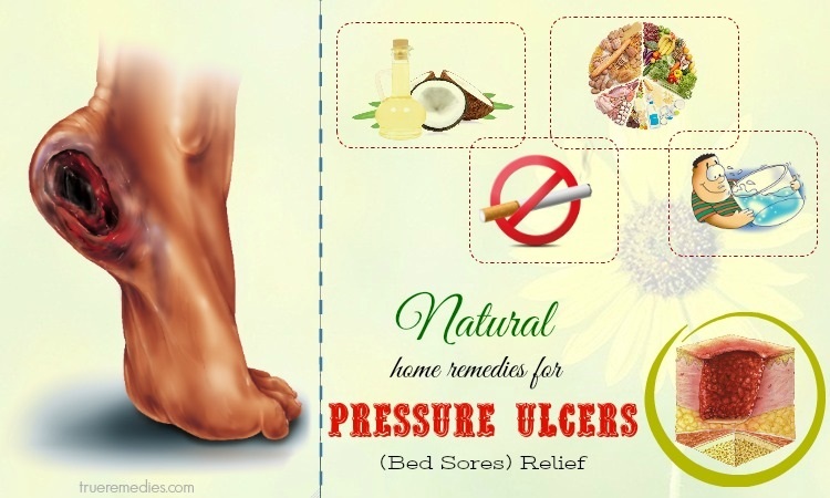 natural home remedies for pressure ulcers