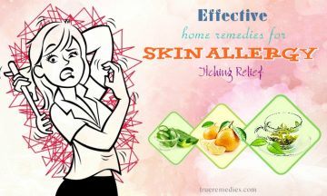 effective home remedies for skin allergy