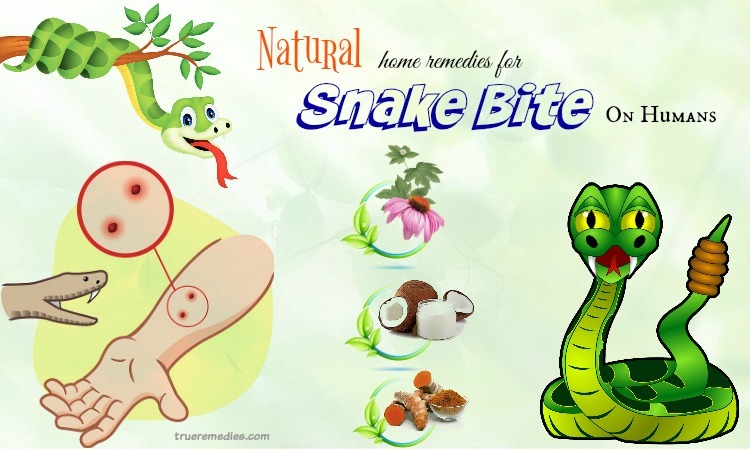 natural home remedies for snake bite