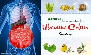 natural home remedies for ulcerative colitis