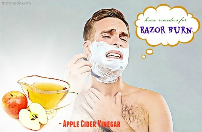home remedies for razor burn - apple cider vinegar