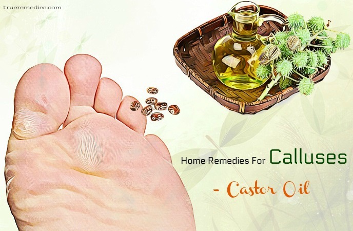 home remedies for calluses - castor oil