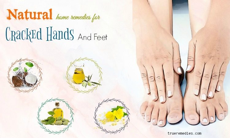 natural home remedies for cracked hands