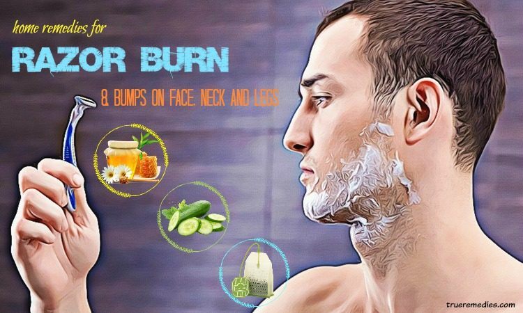 home remedies for razor burn on face