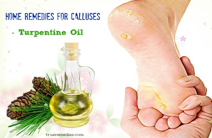 home remedies for calluses - turpentine oil