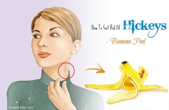 how to get rid of hickeys - banana peel