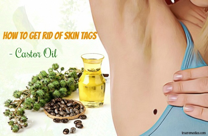 how to get rid of skin tags - castor oil