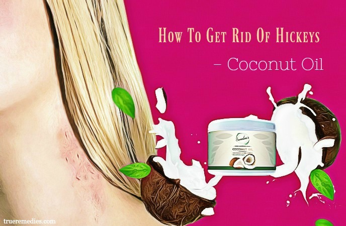 how to get rid of hickeys - coconut oil