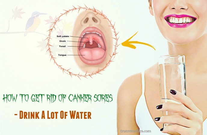 how to get rid of canker sores - drink a lot of water
