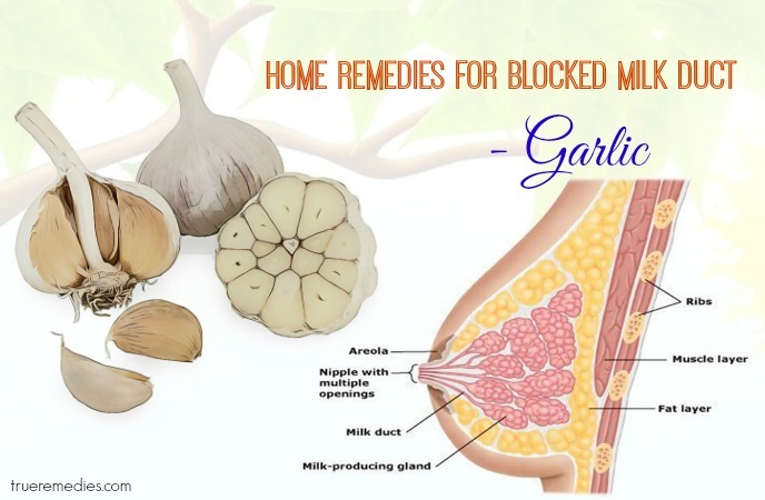 home remedies for blocked milk duct - garlic