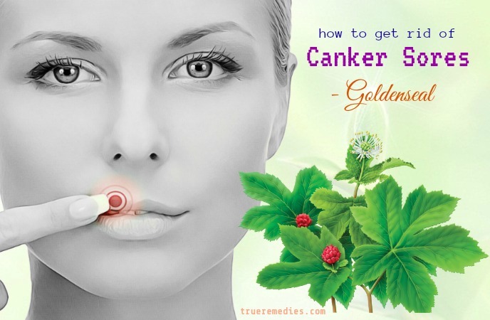 how to get rid of canker sores - goldenseal
