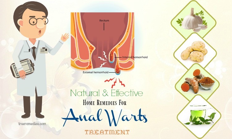 effective home remedies for anal warts