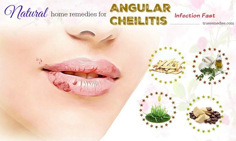natural home remedies for angular cheilitis