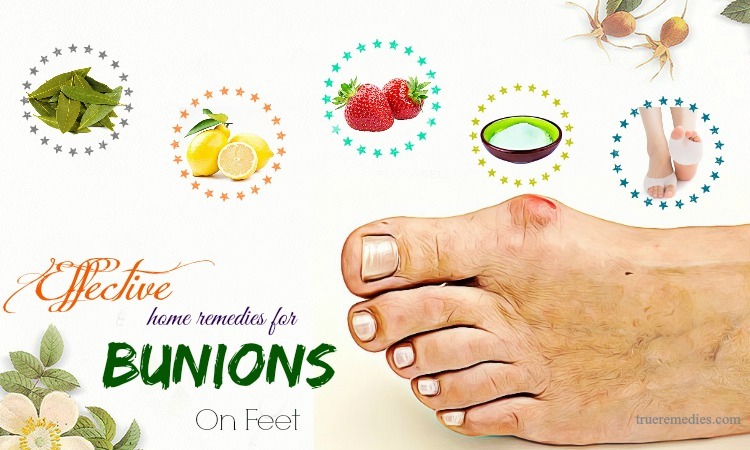 effective home remedies for bunions