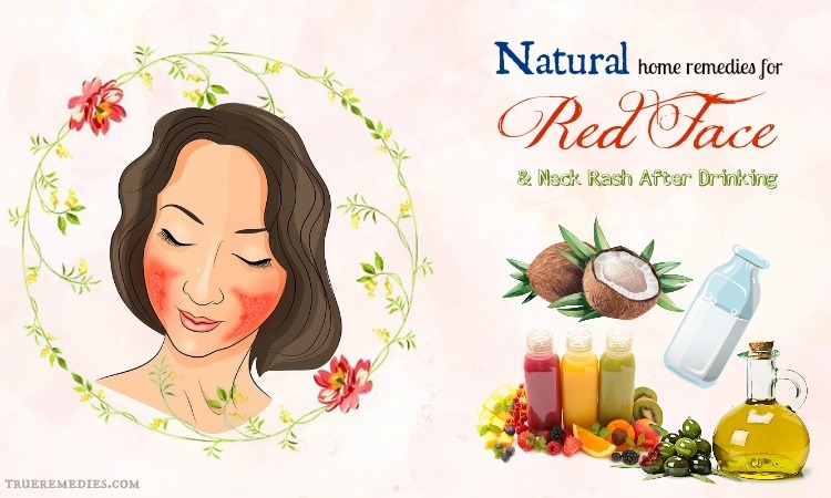 natural home remedies for red face when drinking alcohol