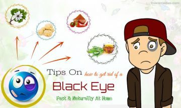 tips on how to get rid of a black eye