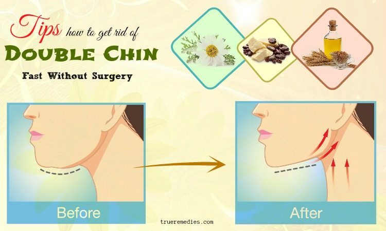 how to get rid of double chin without surgery