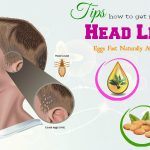 tips on how to get rid of head lice