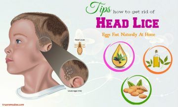 tips on how to get rid of head lice